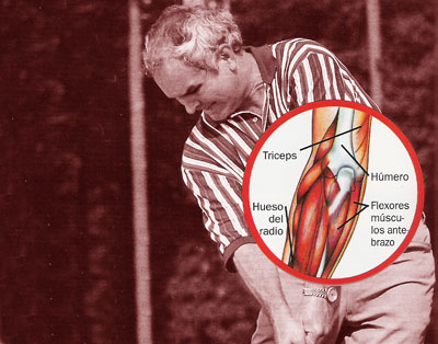 Cómo curar y prevenir el codo del golfista